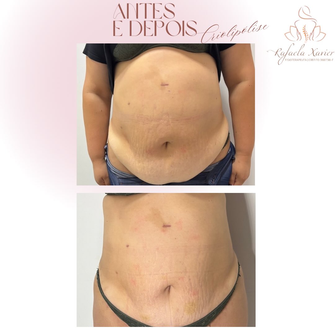 Rotina de atendimentos de fisioterapia e estética em Pouso Alegre